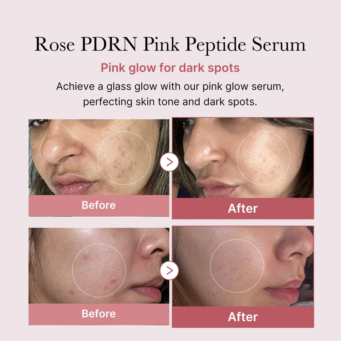 Medicube Salmon Dna Pdrn Pink Peptide Serum 30ml