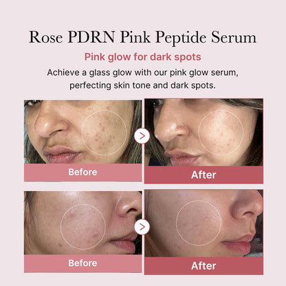 Medicube Salmon Dna Pdrn Pink Peptide Serum 30ml